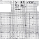 Wolff-Parkinson-White Syndrome in a Young Athlete