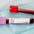 blood vials