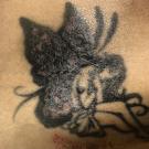 Reaction to Red Tattoo Ink in a Woman With HIV