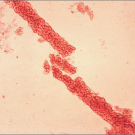 Kidney Disease: A Straightforward Diagnostic Approach