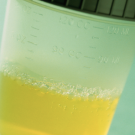 urine sample